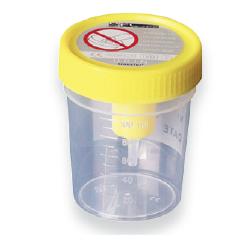 CONTENITORE URINA STERILE MEDIPRESTERIL CON SISTEMA TRANSFERT PER PROVETTE SOTTOVUOTO - farmasconti.eu